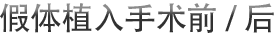 假体植入手术前/后