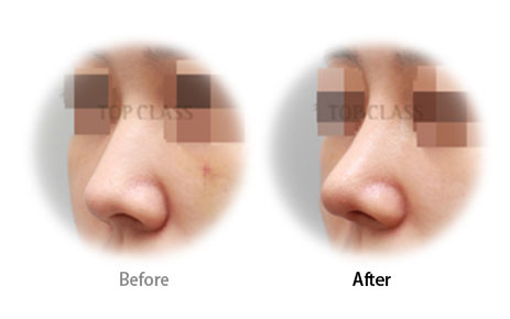 Case05 Before and After