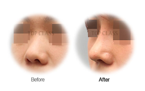 Case04 Before and After