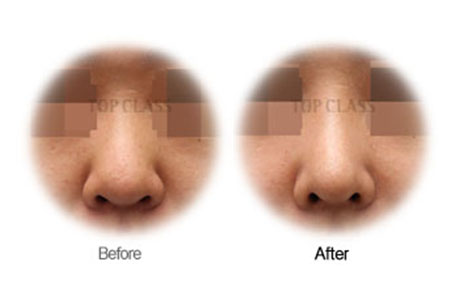 Case01 Before and After