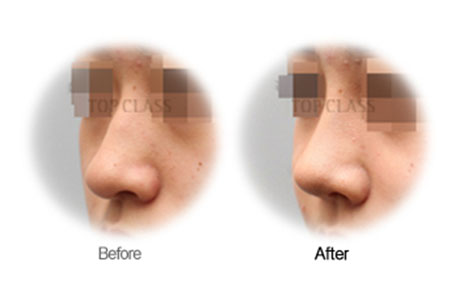 Case06 Before and After