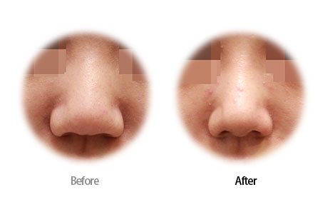 Case05 Before and After