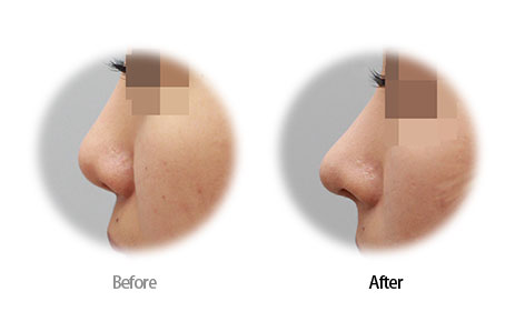 Case10 Before and After