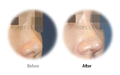 Case07 Before and After