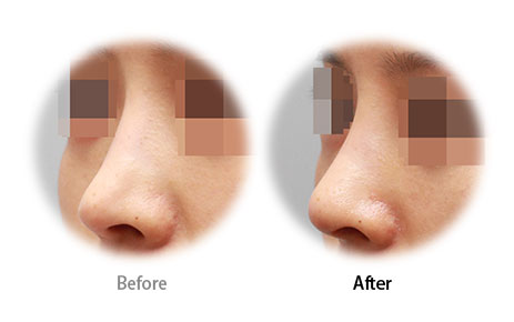 Case10 Before and After