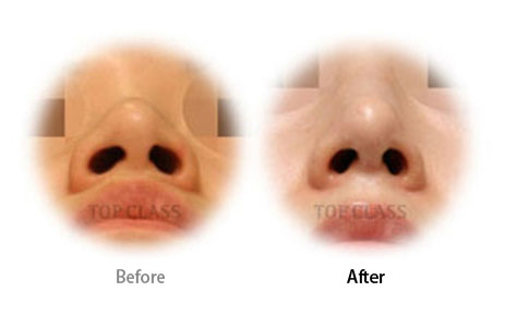 Case01 Before and After