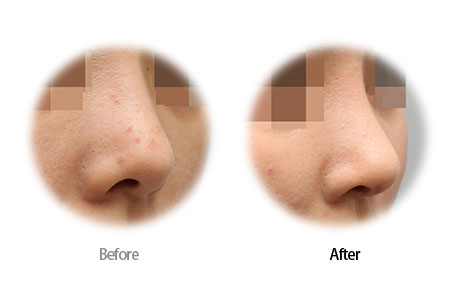 Case01 Before and After