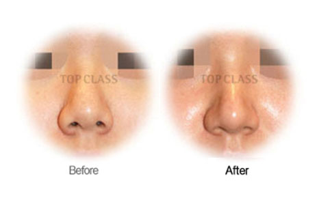 Case03 Before and After