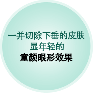 一并切除下垂的皮肤 显年轻的 童颜眼形效果