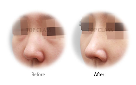 Case04 Before and After