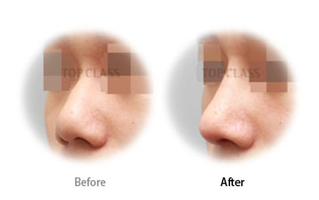 Case09 Before and After