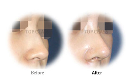 Case05 Before and After