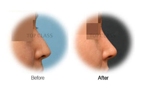 Case02 Before and After