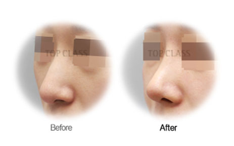 Case04 Before and After