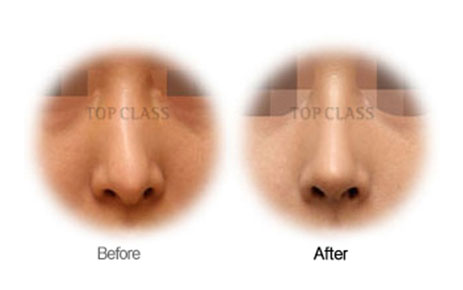 Case01 Before and After