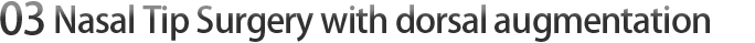 03 Nose Tip Surgery with Rhinoplasty
