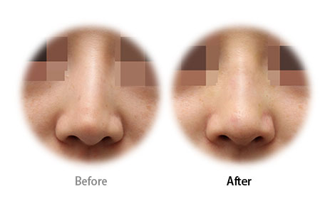 Case02 Before and After