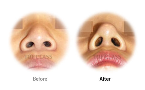 Case02 Before and After